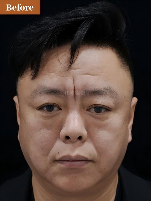 康宁24小时在线套医保微信能用吗怎么弄？官方解答来了